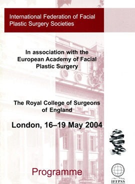 Ρινοπλαστική: Mίκρεμα (σμίκρυνση) της μακριάς μύτης