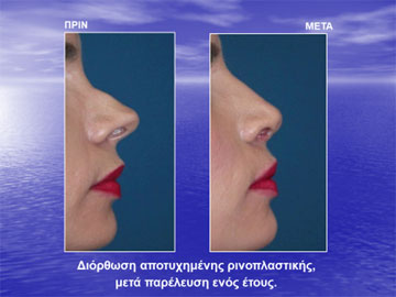 Διαφάνειες από την ομιλία του Dr. med. B. Παυλιδέλη