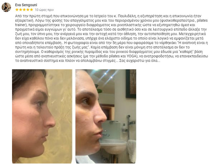 Ρινοπλαστική 2021: Aξιολογήσεις κριτικές Google, Mάρτιος