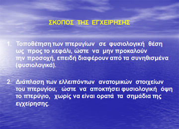 Σκοπός ωτοπλαστικής