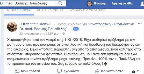 Σχόλια για την ανάρρωση και το αποτέλεσμα ρινοπλαστικής και διόρθωσης του ρινικού διαφράματος της κ. Κατερίνας Φερ... στο facebook, Ιανουάριος 2018