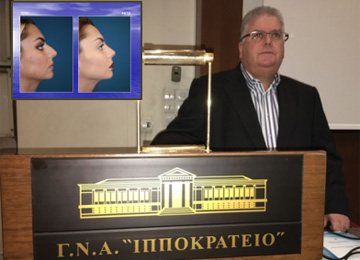 Ρινοπλαστική και Εγχείρηση Ρινικού Διαφράγματος: Μετεκπαιδευτικό πρόγραμμα Iατρικής Σχολής Πανεπιστημίου Αθηνών