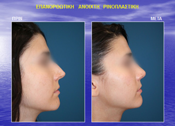 Διαφάνεια από την ομιλία του Dr. med. B. Παυλιδέλη