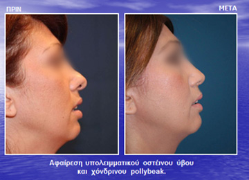 Διαφάνεια από την ομιλία του Dr. med. B. Παυλιδέλη