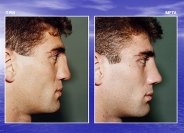 Διαφάνεια από την ομιλία του Dr. med. B. Παυλιδέλη