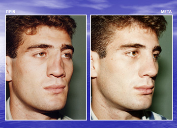 Διαφάνεια από την ομιλία του Dr. med. B. Παυλιδέλη