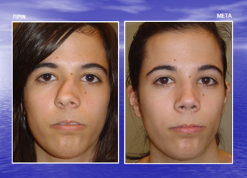 Διαφάνεια από την ομιλία του Dr. med. B. Παυλιδέλη