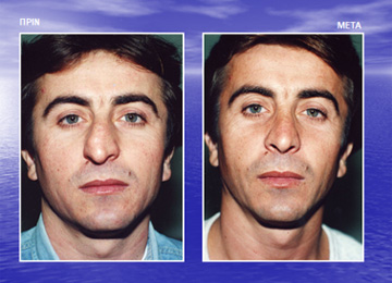 Διαφάνεια από την ομιλία του Dr. med. B. Παυλιδέλη