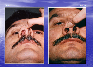 Διαφάνεια από την ομιλία του Dr. med. B. Παυλιδέλη