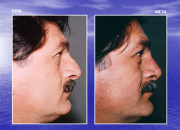 Διαφάνεια από την ομιλία του Dr. med. B. Παυλιδέλη