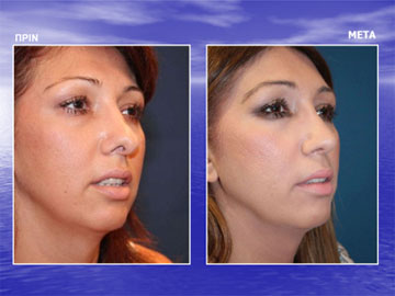 Διαφάνεια από την ομιλία του Dr. med. B. Παυλιδέλη.